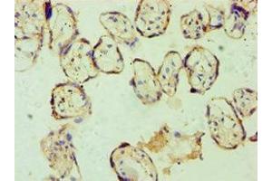 Immunohistochemistry of paraffin-embedded human placenta tissue using ABIN7153663 at dilution of 1:100 (Non-Syndromic Hearing Impairment Protein 5 (GSDME) (AA 1-260) anticorps)