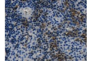 Detection of LSP1 in Rat Lymph node Tissue using Polyclonal Antibody to Lymphocyte Specific Protein 1 (LSP1)