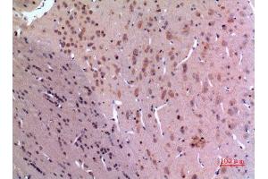 Immunohistochemistry (IHC) analysis of paraffin-embedded Rat Brain, antibody was diluted at 1:100.