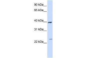 ACADL antibody used at 1 ug/ml to detect target protein. (ACADL anticorps  (Middle Region))