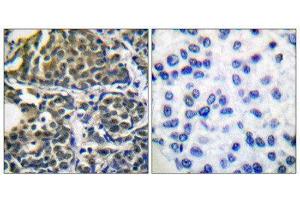 Immunohistochemistry (IHC) image for anti-Heat Shock Protein 90kDa alpha (Cytosolic), Class B Member 1 (HSP90AB1) (Ser254) antibody (ABIN1847890)