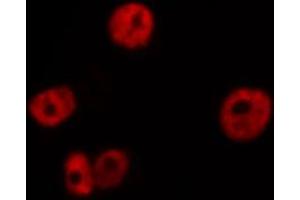 ABIN6266545 staining NIH-3T3 by IF/ICC.