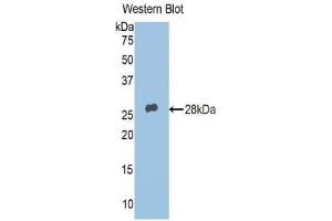 Detection of Recombinant ADRP, Human using Polyclonal Antibody to Adipose Differentiation Related Protein (ADRP) (ADRP anticorps  (AA 5-232))