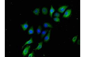 Immunofluorescence staining of A549 cells with ABIN7145367 at 1:133, counter-stained with DAPI. (B3GALT2 anticorps  (AA 201-422))