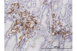 Immunoperoxidase of monoclonal antibody to C20orf31 on formalin-fixed paraffin-embedded human stomach.