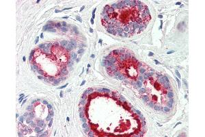 Anti-PIP / GCDFP15 antibody IHC of human breast. (PIP anticorps  (AA 24-34))
