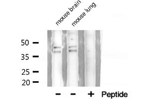 Western blot analysis of hnRNP A2/B1 expression in HepG2 cells (HNRNPA2B1 anticorps  (N-Term))