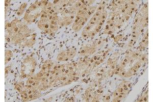 ABIN6273549 at 1/100 staining Human kidney tissue by IHC-P. (POGZ anticorps  (Internal Region))