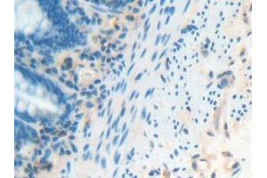 Detection of IFNa/bR1 in Human Rectum Tissue using Polyclonal Antibody to Interferon Alpha/Beta Receptor 1 (IFNa/bR1)