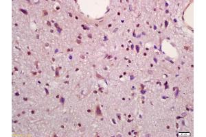 Formalin-fixed and paraffin embedded rat brain labeled with Anti-MAPKAPK5 Polyclonal Antibody, Unconjugated (ABIN754378) at 1:200 followed by conjugation to the secondary antibody and DAB staining (MAPKAP Kinase 5 anticorps  (AA 89-190))