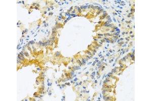 Immunohistochemistry of paraffin-embedded Mouse lung using IL20 Polyclonal Antibody at dilution of 1:100 (40x lens). (IL-20 anticorps)