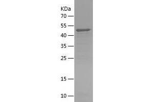 Western Blotting (WB) image for Abelson Helper Integration Site 1 (AHI1) (AA 1-335) protein (His tag) (ABIN7121634)