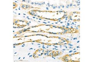 Immunohistochemistry of paraffin embedded human kidney using ATP1HC1 (ABIN7073160) at dilution of 1:500 (400x lens) (ATP12A anticorps)