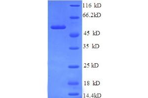 SDS-PAGE (SDS) image for Islet Cell Autoantigen 1, 69kDa (ICA1) (AA 1-268), (partial) protein (His tag) (ABIN5713518)