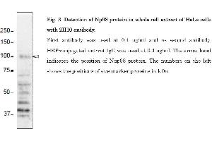 Western Blotting (WB) image for anti-Nucleoporin 98kDa (NUP98) (AA 1-466) antibody (ABIN2452066) (NUP98 anticorps  (AA 1-466))