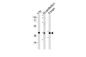 NeuroD1 Antibody  (ABIN388766 and ABIN2839060) western blot analysis in Y79 cell line ,mouse cerebellum and rat brain tissue lysates (35 μg/lane). (NEUROD1 anticorps  (C-Term))