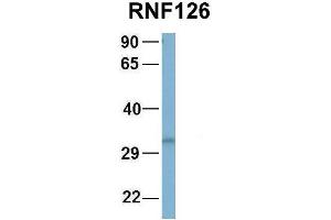 Host:  Rabbit  Target Name:  NOP56  Sample Type:  Human Fetal Brain  Antibody Dilution:  1. (RNF126 anticorps  (N-Term))