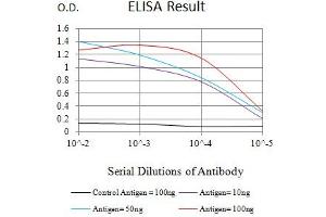 Black line: Control Antigen (100 ng),Purple line: Antigen (10 ng), Blue line: Antigen (50 ng), Red line:Antigen (100 ng)