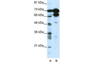 WB Suggested Anti-ZNF76 Antibody Titration:  1. (ZNF76 anticorps  (N-Term))