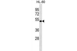 Western Blotting (WB) image for anti-N-Acylethanolamine Acid Amidase (NAAA) antibody (ABIN3000319) (NAAA anticorps)