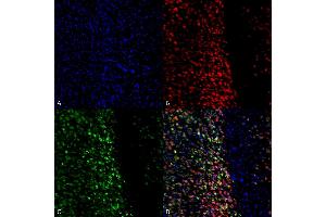 Immunocytochemistry/Immunofluorescence analysis using Rabbit Anti-Alpha Synuclein pSer129 Polyclonal Antibody (ABIN5650937).