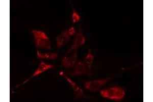 ABIN6276612 staining HuvEc cells by IF/ICC. (CA3 anticorps  (N-Term))