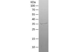 Western Blotting (WB) image for Xenotropic and Polytropic Retrovirus Receptor 1 (xpr1) (AA 1-305) protein (His tag) (ABIN7122383)