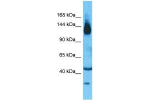 Host:  Rabbit  Target Name:  SLC12A2  Sample Type:  Thymus Tumor lysates  Antibody Dilution:  1.