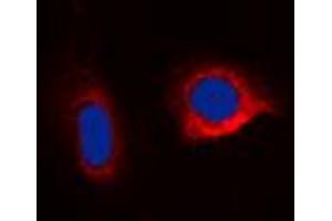 Immunofluorescent analysis of Caspase 6 staining in HepG2 cells. (Caspase 6 anticorps  (C-Term))