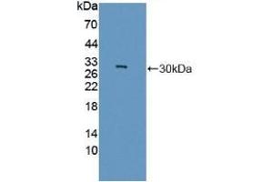 Detection of Recombinant GAMT, Rat using Polyclonal Antibody to Guanidinoacetate-N-Methyltransferase (GAMT)