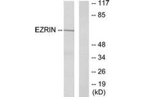 Western Blotting (WB) image for anti-Ezrin (EZR) (AA 321-370) antibody (ABIN2888987) (Ezrin anticorps  (AA 321-370))