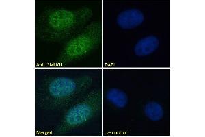 ABIN185204 Immunofluorescence analysis of paraformaldehyde fixed U2OS cells, permeabilized with 0.