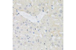 Immunohistochemistry of paraffin-embedded rat liver using SLC3A2 antibody (ABIN1876903) at dilution of 1:100 (40x lens). (SLC3A2 anticorps)
