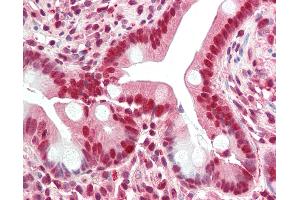 Anti-GHDC antibody IHC staining of human small intestine.