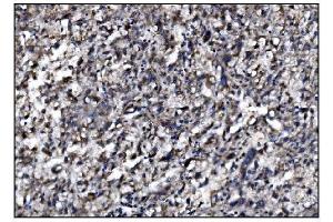 IHC analysis of SLFN11 using anti-SLFN11 antibody (ABIN7599761). (SLFN11 anticorps  (AA 114-794))
