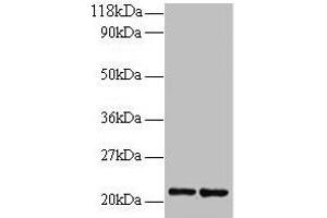 Western blot All lanes: RPS9 antibody at 2 μg/mL Lane 1: 293T whole cell lysate Lane 2: EC109 whole cell lysate Secondary Goat polyclonal to rabbit IgG at 1/15000 dilution Predicted band size: 21 kDa Observed band size: 21 kDa (RPS9 anticorps  (AA 2-184))