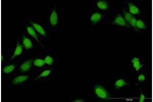 Immunofluorescence of purified MaxPab antibody to RBL1 on HeLa cell.