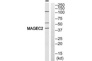 Western blot analysis of extracts from 293 cells, using MAGEC2 antibody. (MAGEC2 anticorps  (Internal Region))