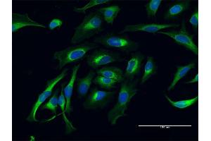Immunofluorescence of purified MaxPab antibody to LAMB1 on HeLa cell. (Laminin beta 1 anticorps  (AA 1-1786))