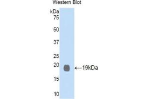 Western blot analysis of the recombinant protein. (GDF1 anticorps  (AA 230-357))