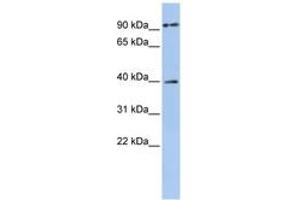 Image no. 1 for anti-Melanoma Antigen Family A, 6 (MAGEA6) (AA 216-265) antibody (ABIN6743406) (MAGEA6 anticorps  (AA 216-265))
