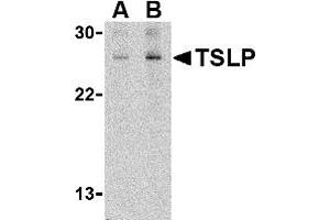 Western Blotting (WB) image for anti-Thymic Stromal Lymphopoietin (TSLP) (C-Term) antibody (ABIN1030782) (Thymic Stromal Lymphopoietin anticorps  (C-Term))