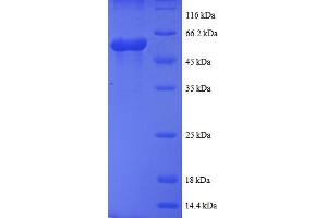 SDS-PAGE (SDS) image for Casein Kinase 1, epsilon (CSNK1E) (AA 17-231) protein (GST tag) (ABIN5712131) (CK1 epsilon Protein (AA 17-231) (GST tag))