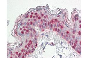 Human Skin: Formalin-Fixed, Paraffin-Embedded (FFPE)