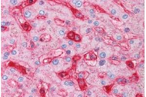 Human Liver (formalin-fixed, paraffin-embedded) stained with B2M antibody ABIN334257 at 5 ug/ml followed by biotinylated anti-mouse IgG secondary antibody ABIN481714, alkaline phosphatase-streptavidin and chromogen. (beta-2 Microglobulin anticorps)