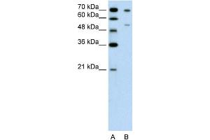 WB Suggested Anti-FOXB2 Antibody Titration:  0. (FOXB2 anticorps  (N-Term))