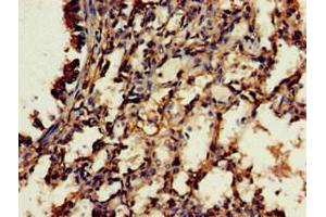 Immunohistochemistry of paraffin-embedded human lung tissue using ABIN7166771 at dilution of 1:100 (RBFA anticorps  (AA 201-343))