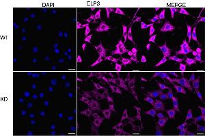 Immunocytochemical staining of HT- cells using ELP3 antibody (ABIN7798434), 1:1,000), Top panel: wild-type (WT), Bottom panal: ELP3 shRNA knockdown (KD).