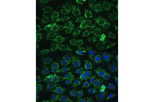 Immunofluorescence analysis of C6 cells using C1 Polyclonal Antibody (ABIN7265723) at dilution of 1:100 (40x lens).