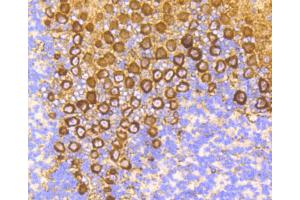 Immunohistochemistry of paraffin-embedded mouse brain using PRKCA antibody (ABIN4904772) at dilution of 1:100 (40x lens). (PKC alpha anticorps)